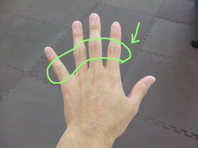 骨折 突き指 違い と の 突き指で来院→指の骨折（ヒビ）治療ケース（応急対応含む）